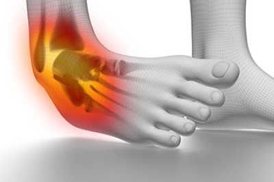 Ankle Sprains and Podiatric Care